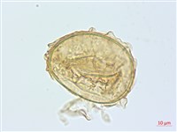 奄美雙蓋蕨藏品圖，第2張