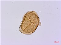 長苞雙蓋蕨、鱗柄雙蓋蕨藏品圖，第3張
