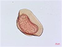 川上氏雙蓋蕨藏品圖，第2張