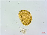 姬蹄蓋蕨藏品圖，第2張