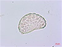 小膜蓋蕨、臺灣小膜蓋蕨藏品圖，第1張