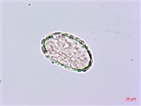 小膜蓋蕨、臺灣小膜蓋蕨藏品圖，第2張