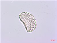 小膜蓋蕨、臺灣小膜蓋蕨藏品圖，第3張