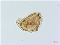 深山雙蓋蕨藏品圖，第1張