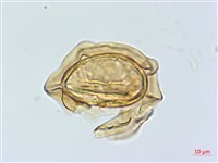 深山雙蓋蕨藏品圖，第3張