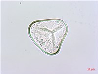 粗毛鱗蓋蕨藏品圖，第1張