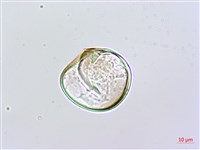 粗毛鱗蓋蕨藏品圖，第3張