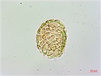 大膜蓋蕨藏品圖，第1張