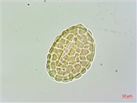 大膜蓋蕨藏品圖，第2張