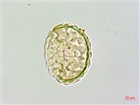 大膜蓋蕨藏品圖，第3張