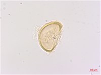 深山雙蓋蕨藏品圖，第1張