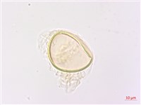 深山雙蓋蕨藏品圖，第3張