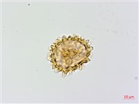 亞蹄蓋蕨藏品圖，第1張