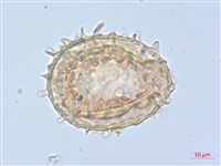 單葉雙蓋蕨藏品圖，第1張