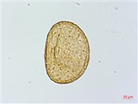 小葉蹄蓋蕨藏品圖，第3張