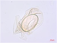 川上氏雙蓋蕨藏品圖，第2張