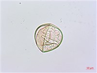 熱帶鱗蓋蕨藏品圖，第2張