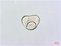 熱帶鱗蓋蕨藏品圖，第3張