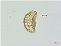 廣葉深山雙蓋蕨藏品圖，第3張