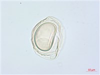 疏葉雙蓋蕨藏品圖，第1張