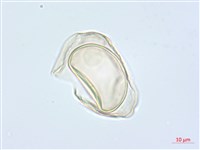 疏葉雙蓋蕨藏品圖，第2張