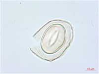 疏葉雙蓋蕨藏品圖，第3張