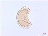 翅柄雙蓋蕨藏品圖，第1張