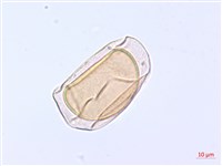 翅柄雙蓋蕨藏品圖，第2張