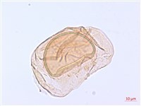翅柄雙蓋蕨藏品圖，第3張