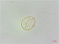 脈果石薯藏品圖，第3張