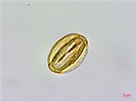 金絲梅、雲南連翹、芒種花藏品圖，第3張