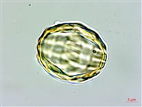 瓜子金藏品圖，第2張