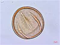 長刺酸模藏品圖，第2張