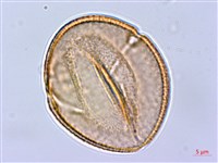 長刺酸模藏品圖，第3張