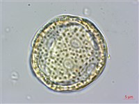 雞冠花藏品圖，第4張