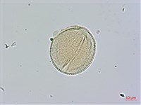 山菜豆藏品圖，第1張