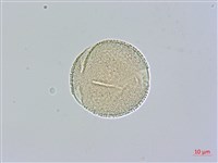 山菜豆藏品圖，第2張