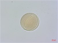 山菜豆藏品圖，第3張