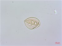 黑板樹藏品圖，第2張