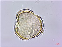 亨利氏伊立基藤藏品圖，第2張