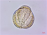 亨利氏伊立基藤藏品圖，第4張