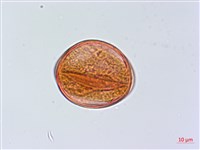 慈恩胡頹子藏品圖，第3張