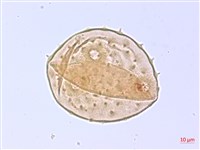 翅子樹、裡白翅子樹、臺灣翅子樹藏品圖，第2張