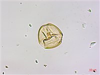 刀葉槲寄生、刀葉桑寄生藏品圖，第1張