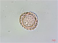 豬草、瘤果菊藏品圖，第3張