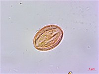 華鉤藤藏品圖，第3張