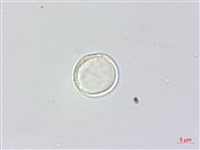 瘤冠麻藏品圖，第3張