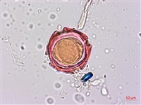 蘭嶼馬蹄花藏品圖，第4張