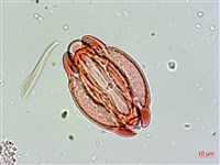 棋盤腳樹藏品圖，第3張