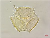 假赤楊、有丹樹、丹招樹藏品圖，第3張